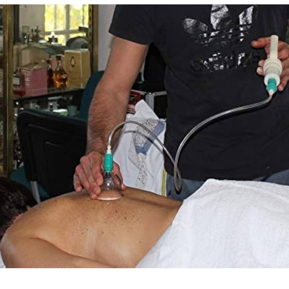 Professional authentic 22 pcs cupping Chinese medicine , pain relief set, a must - Picture 14 of 17